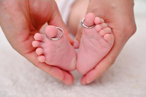 宜都孕妇怎样预防妊娠纹